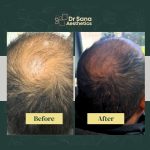 Hair & Scalp Concerns Treatment