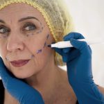 Wrinkle Reduction