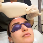 IPL Treatments
