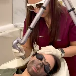 PICO Laser Treatments