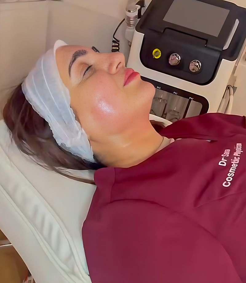 chemical peels