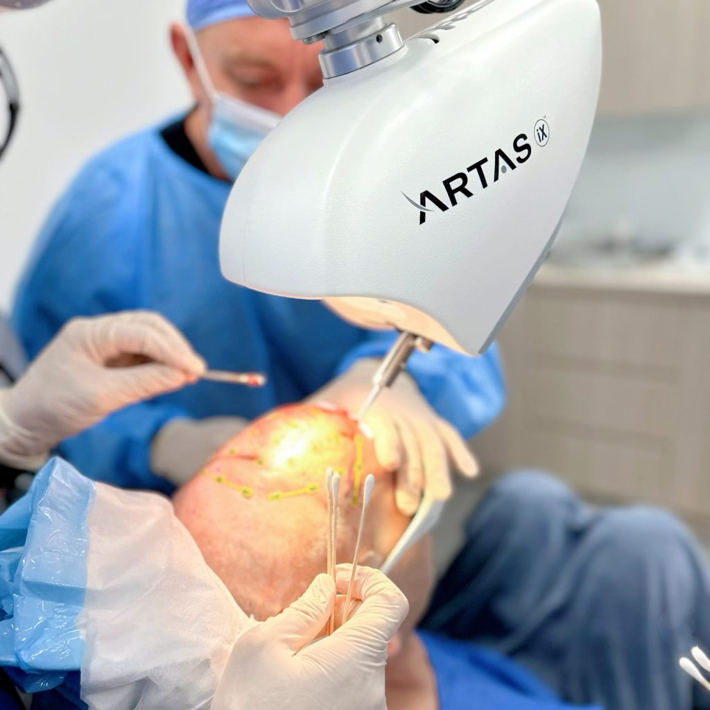Hair Transplant