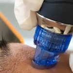 Hydraglow Treatment