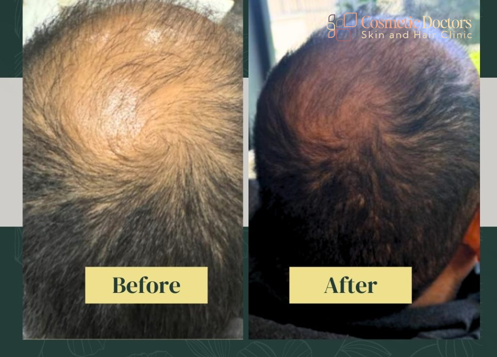 Hair Treatment