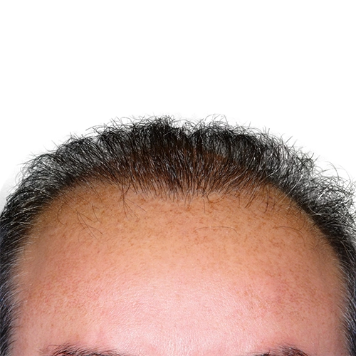 artas_hair_2_after.webp