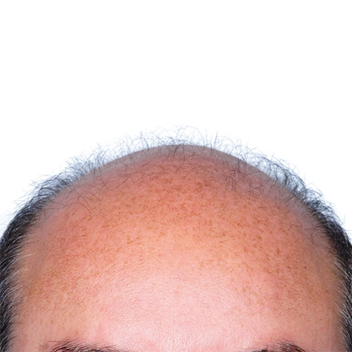 artas_hair_2_before.webp