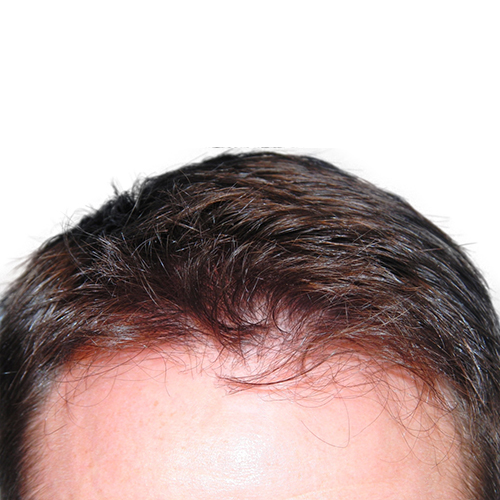 artas_hair_3_after-1.jpg