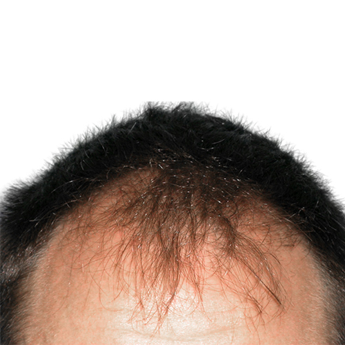 artas_hair_3_before-1.jpg